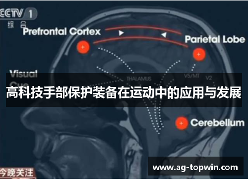 高科技手部保护装备在运动中的应用与发展